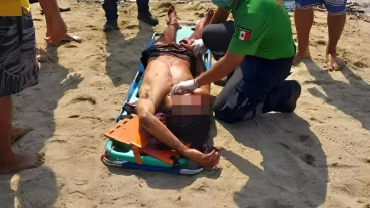 Brutal ataque a machetazos a una necochense y dos cordobeses en una playa mexicana