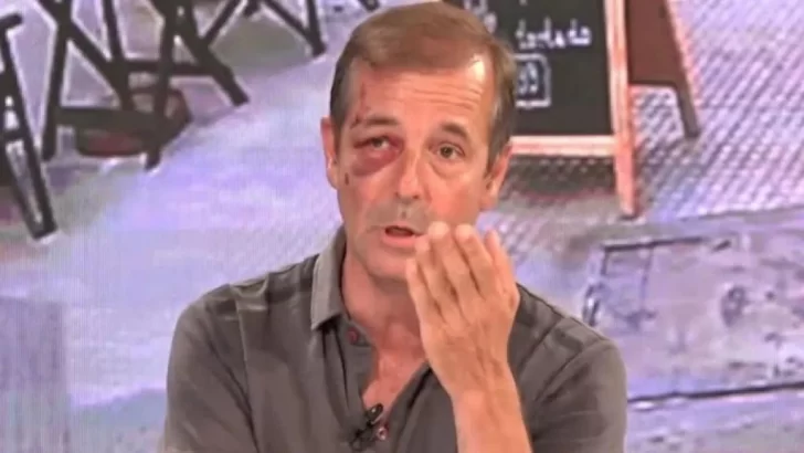 El periodista Fabián Rubino fue operado de urgencia tras sufrir un robo