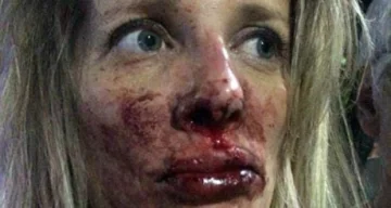 Caballito: Dos mujeres fueron golpeadas brutalmente en la calle