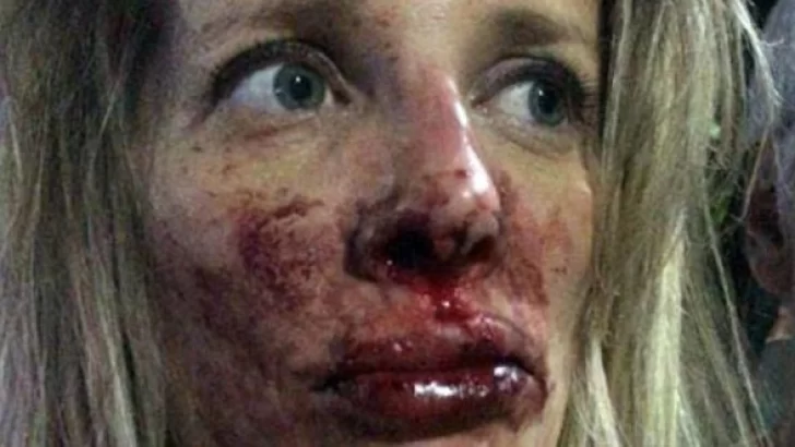 Caballito: Dos mujeres fueron golpeadas brutalmente en la calle