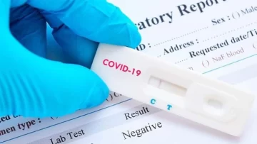 Establecen los mecanismos de notificación del autotest de coronavirus