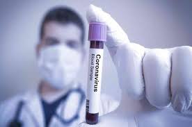 Ya se realizaron 10.709 test de coronavirus y son 106 laboratorios los que analizan muestras