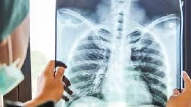 En Necochea no se han registrado contagios de tuberculosis en el sector público