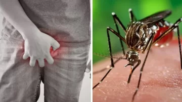 Un joven de 17 años sufrió una erección de 18 horas tras contagiarse de dengue
