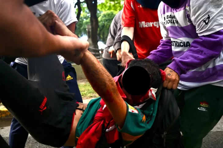 Parte médico de Pablo Grillo, el fotógrafo atacado por policías en la marcha de los jubilados