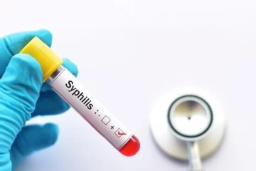 Preocupa el avance de la sífilis: se triplicaron los casos en adolescentes y recién nacidos