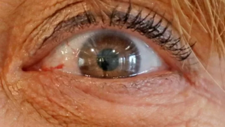 Emplean la IA para predecir el riesgo de alzheimer a través de las retinas
