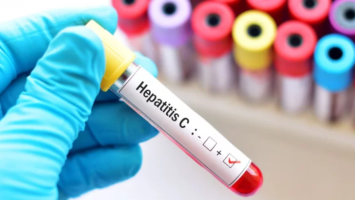 Prevención, vacunas y testeos, las claves contra las hepatitis virales
