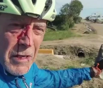 Un excombatiente fue salvajemente golpeado en Quequén mientras andaba en bicicleta