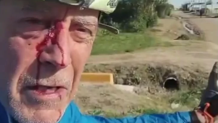 Un excombatiente fue salvajemente golpeado en Quequén mientras andaba en bicicleta