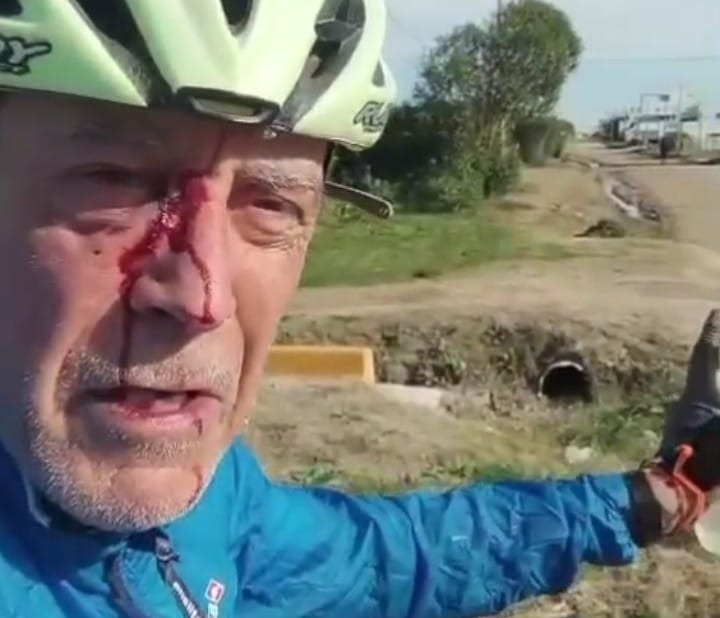 Un excombatiente fue salvajemente golpeado en Quequén mientras andaba en bicicleta