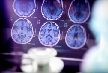 ¿Nuevos pasos en el alzheimer? un compuesto de litio restaura la memoria en ratones