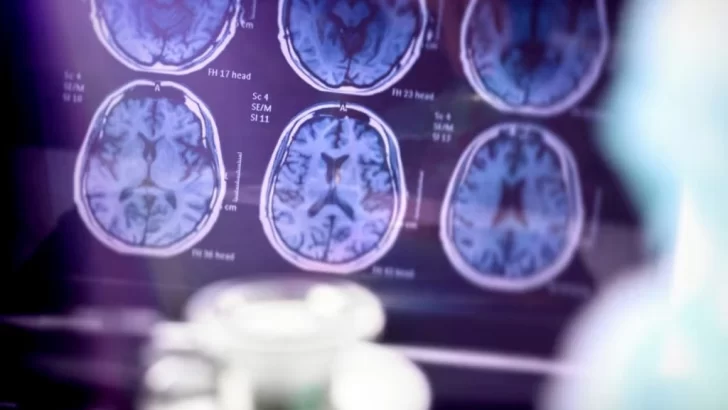 ¿Nuevos pasos en el alzheimer? un compuesto de litio restaura la memoria en ratones