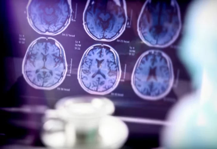 ¿Nuevos pasos en el alzheimer? un compuesto de litio restaura la memoria en ratones