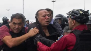 Berni, tras ser asistido en un hospital: “Duele más que un bonaerense fue asesinado”