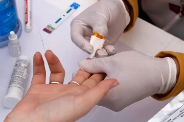 ¿Dónde será la jornada de pruebas rápidas de sífilis y VIH?