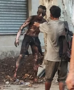 Intentó robar cables de alta tensión y se electrocutó: tiene el 90 por ciento del cuerpo quemado