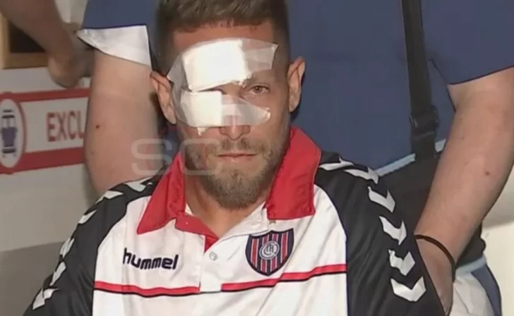 Así abandonaba el hospital el jugador de Chacarita agredido por un botellazo