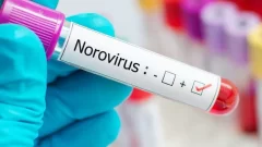 Qué es el norovirus, la enfermedad que afectó a 180 estudiantes en Bariloche