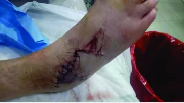 Un guard rail en mal estado casi provoca una tragedia