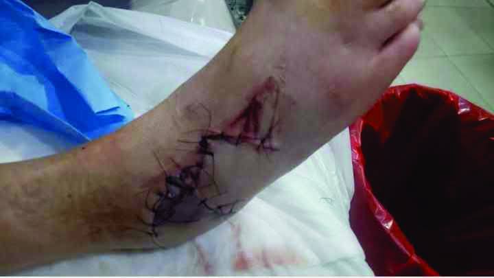 Un guard rail en mal estado casi provoca una tragedia