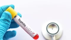 Preocupa el avance de la sífilis: se triplicaron los casos en adolescentes y recién nacidos