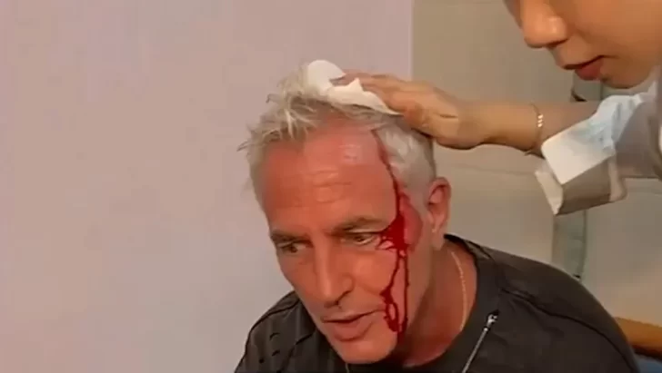 Marley se accidentó en Tailandia: “Quedé chorreando sangre”