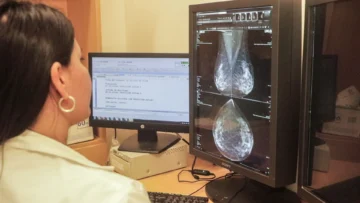Cáncer de mama: jornada en el parque entre el Puerto y Alquimia Rosa