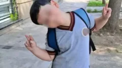 Bastián fue operado por sexta vez y se le realizó una traqueotomía